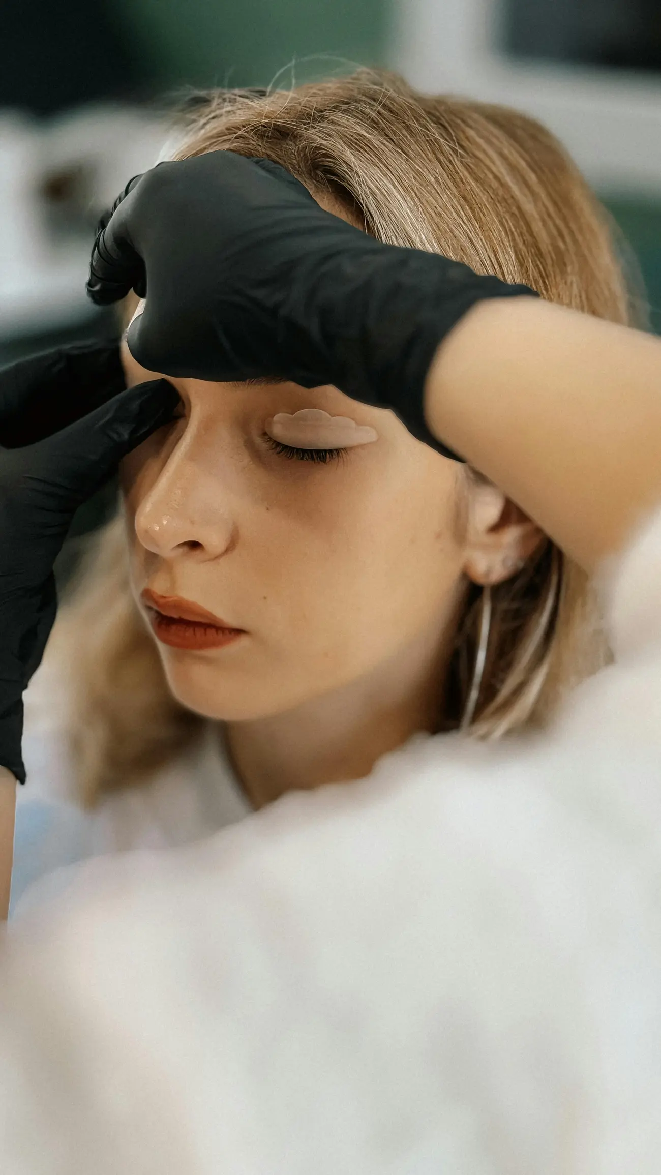 Blepharoplasty — detail