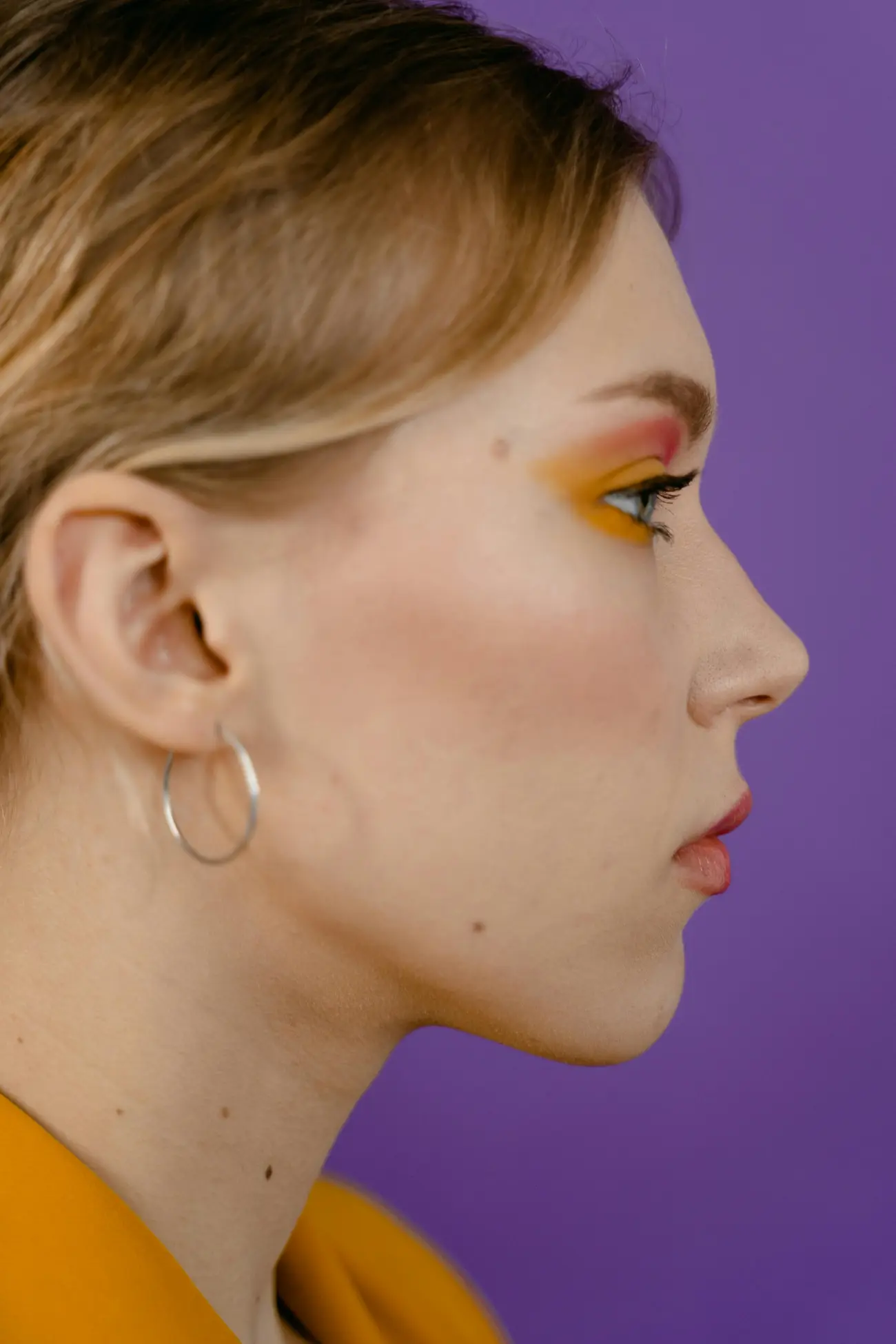 Rhinoplasty — procedure