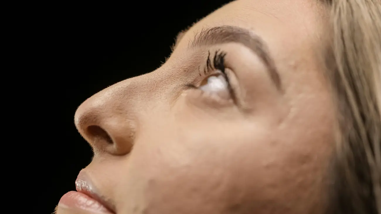 Rhinoplasty — detail